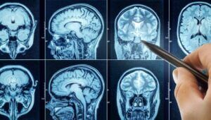 Misdiagnosis of Cancer